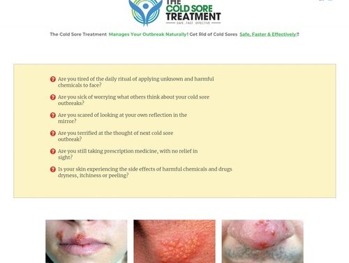 Cold Sore Treatment – How to Get Rid of Cold Sores Faster