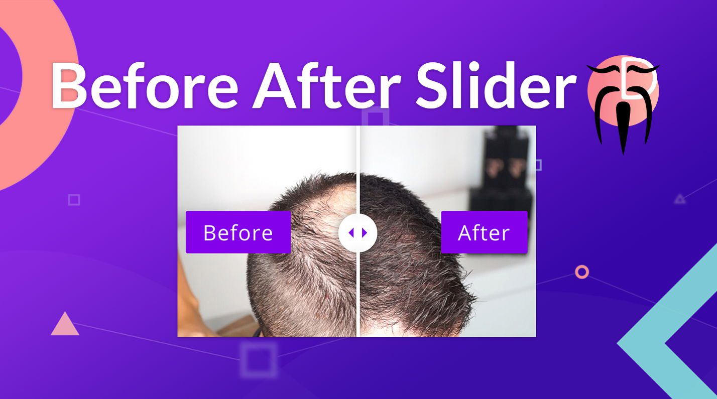 Promotional image for Before After Slider